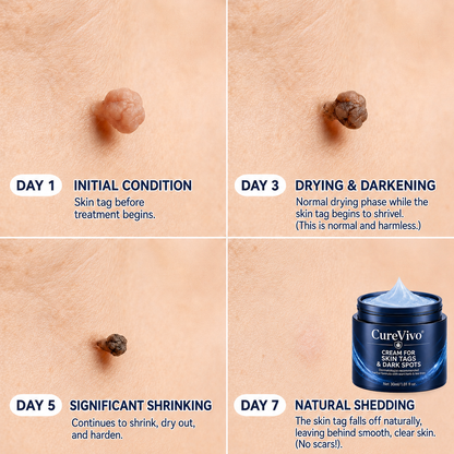 𝗖𝘂𝗿𝗲𝗩𝗶𝘃𝗼® Add a second item and enjoy 45% off!
